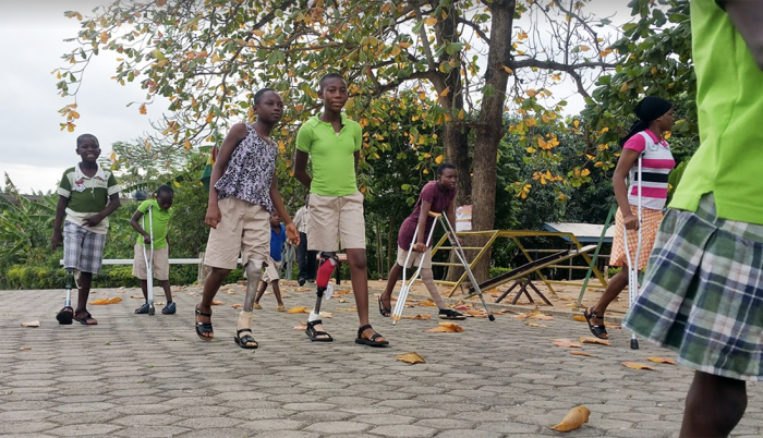 Legs4Africa Seek Prosthetic Legs