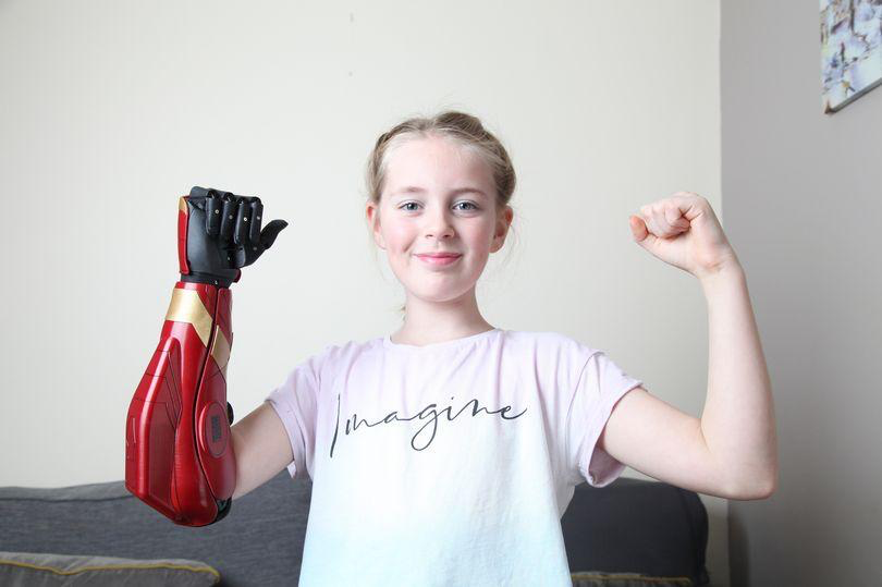 Meet Open Bionics – changing life for below-elbow limb-different kids
