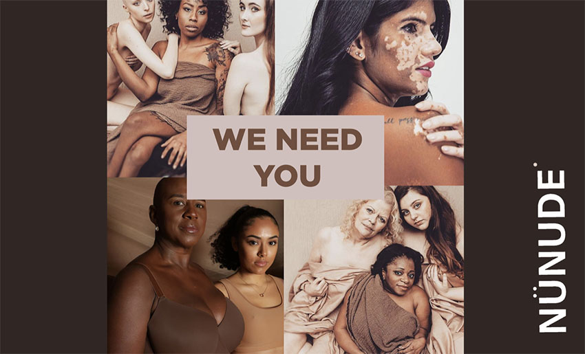 Opportunity! Women with a difference required for photoshoot