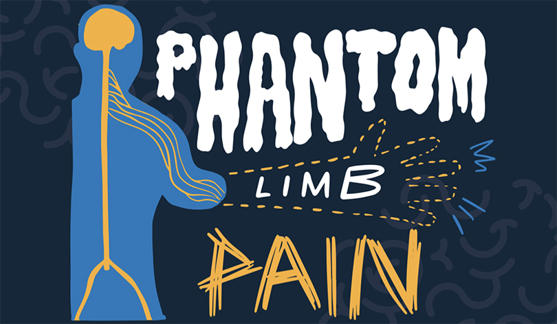 Phantom Limb Pain Live Webinar