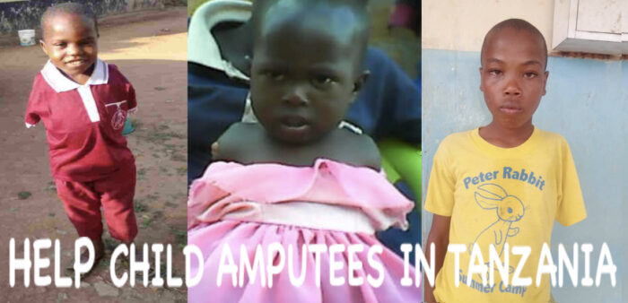 Tanzanian Amputees need our help