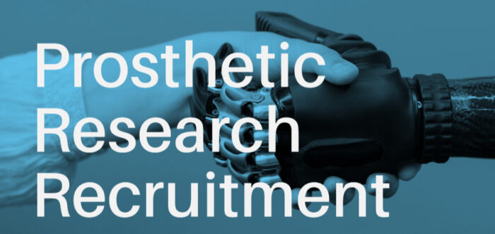 Prosthetic Research Recruitment